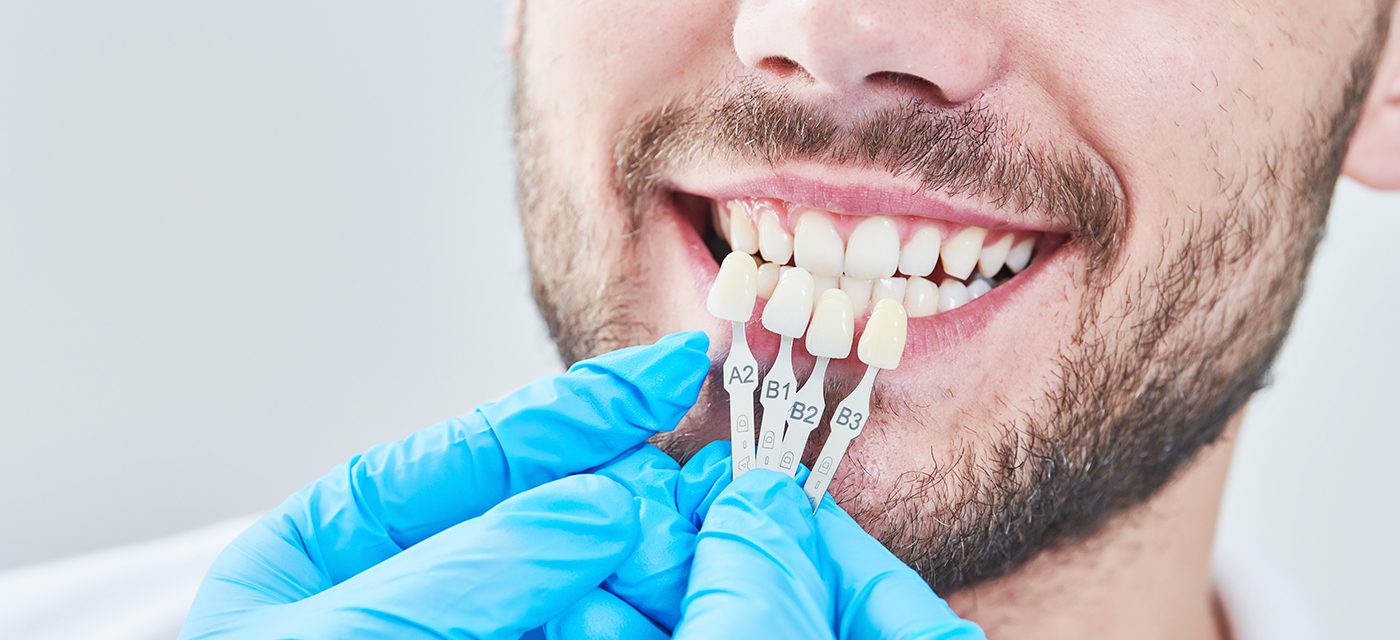 Hombre Sonriendo por su Reconstrucción Dental