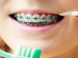 Sonrisa con brackets junto con cepillos especiales para el cuidado de la Ortodoncia