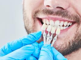 Hombre Sonriendo por su Reconstrucción Dental